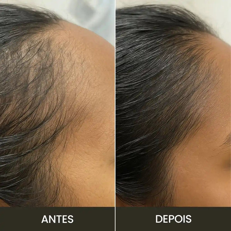 Escova de Terapia Capilar: TheraBrush Smarts 4 em 1