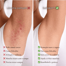 Depilador Feminino 2 em 1 | SoftSkin™