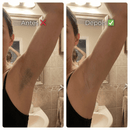 Depilador Feminino 2 em 1 | SoftSkin™