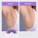 Depilador Elétrico Unissex Corporal Recarregável